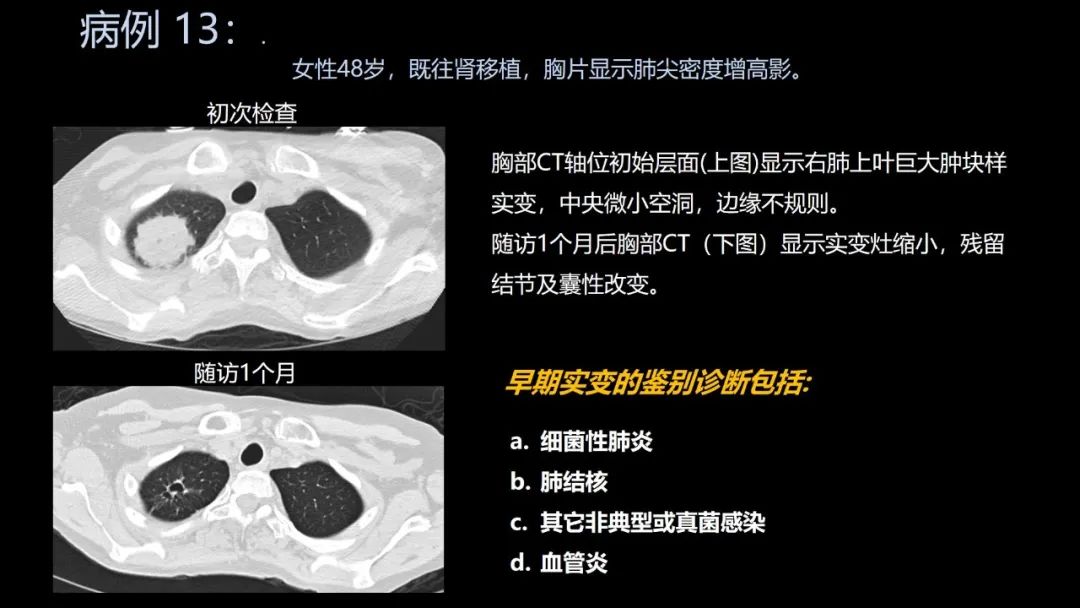 影像PPT - 【PPT】共通之处:同时累及中枢神经系统和心肺系统的疾病-77 影像PPT - 【PPT】共通之处:同时累及中枢神经系统和心肺系统的疾病-77