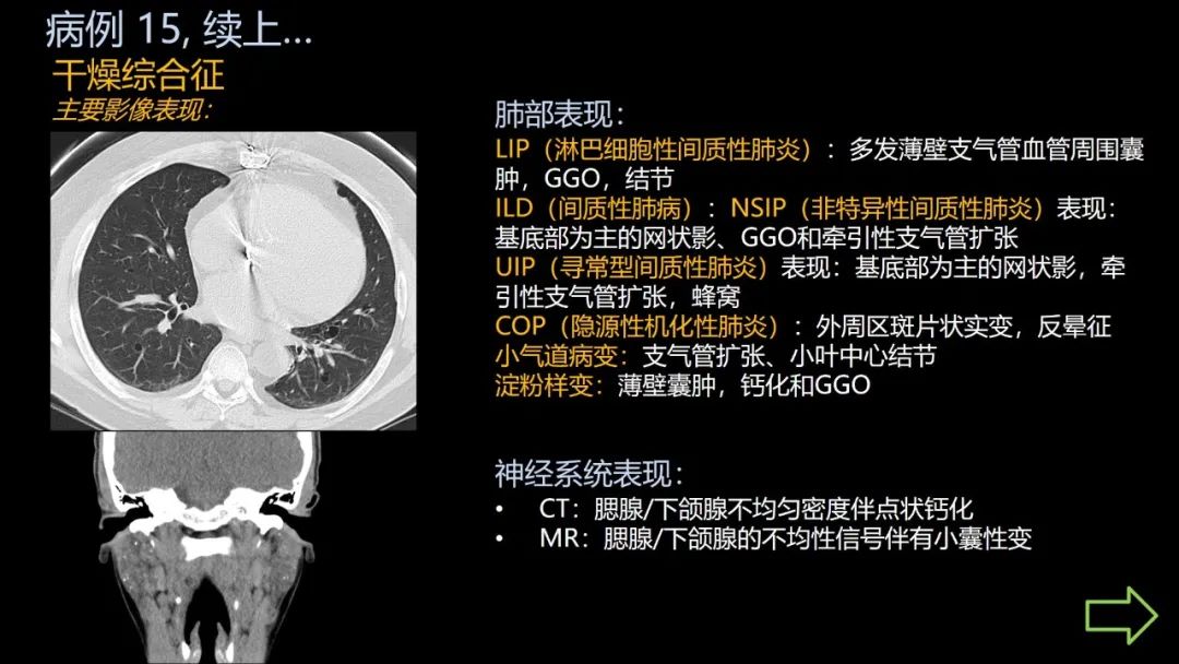 影像PPT - 【PPT】共通之处:同时累及中枢神经系统和心肺系统的疾病-93 影像PPT - 【PPT】共通之处:同时累及中枢神经系统和心肺系统的疾病-93