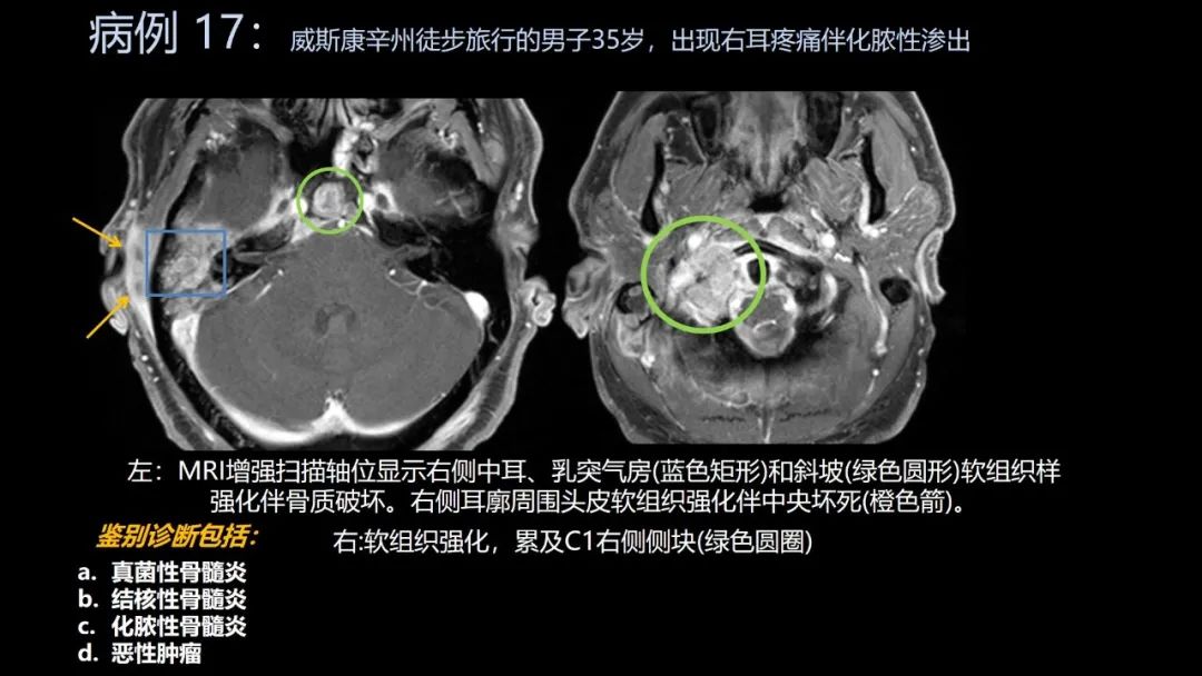 影像PPT - 【PPT】共通之处:同时累及中枢神经系统和心肺系统的疾病-101 影像PPT - 【PPT】共通之处:同时累及中枢神经系统和心肺系统的疾病-101
