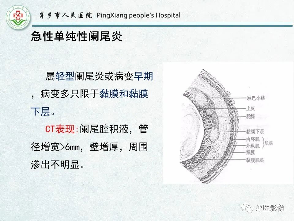影像PPT - 【PPT】右下腹相关炎性病变-13