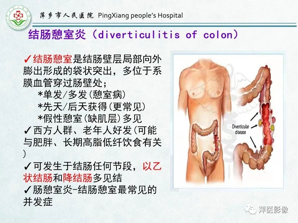 影像PPT - 【PPT】右下腹相关炎性病变-26