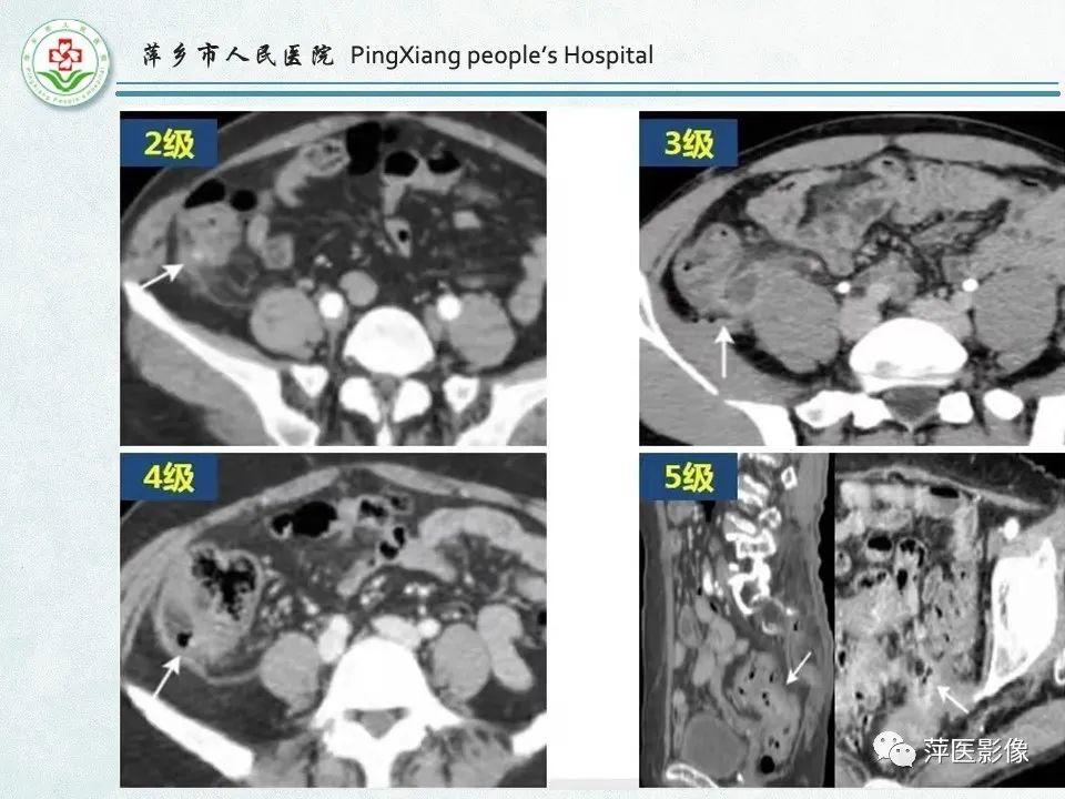 影像PPT - 【PPT】右下腹相关炎性病变-32