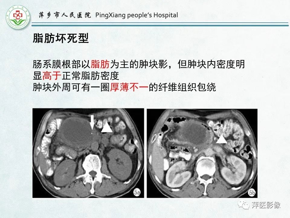 影像PPT - 【PPT】右下腹相关炎性病变-47
