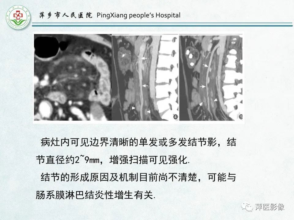 影像PPT - 【PPT】右下腹相关炎性病变-46