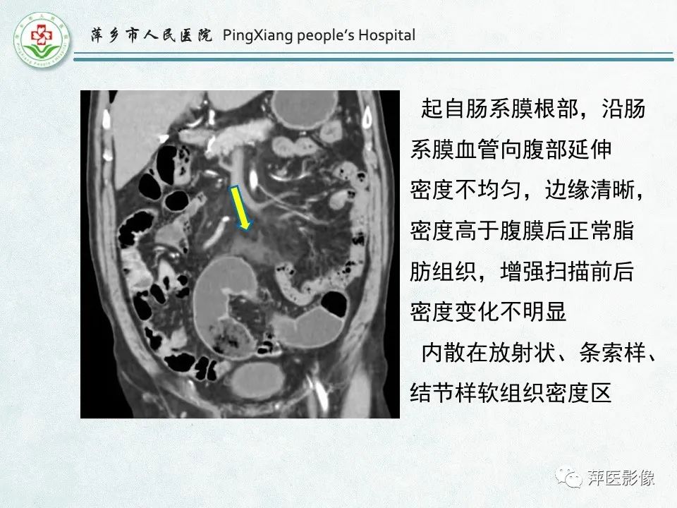 影像PPT - 【PPT】右下腹相关炎性病变-43