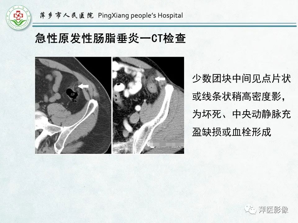 影像PPT - 【PPT】右下腹相关炎性病变-67