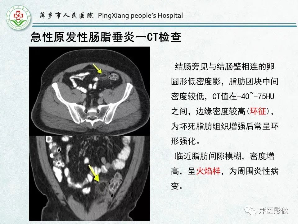 影像PPT - 【PPT】右下腹相关炎性病变-65