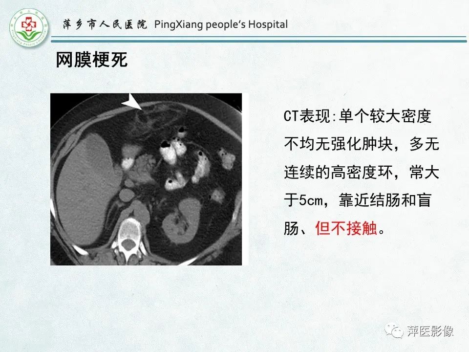 影像PPT - 【PPT】右下腹相关炎性病变-77
