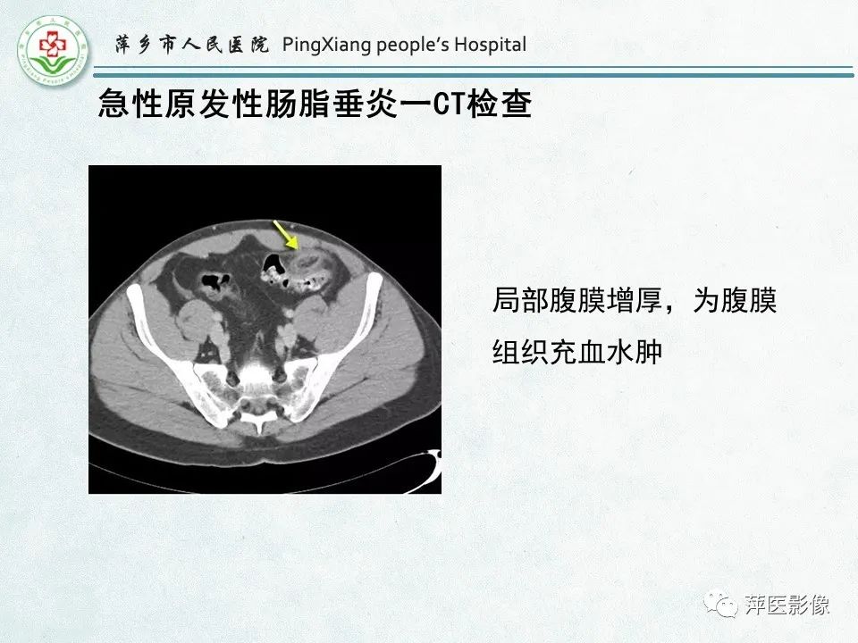影像PPT - 【PPT】右下腹相关炎性病变-66