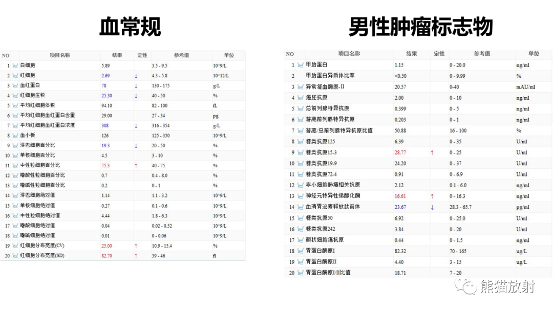 影像PPT - 【病例】髓外造血2例CT影像-10