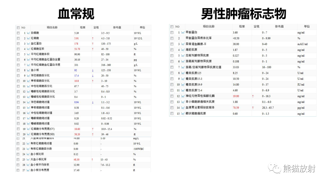 影像PPT - 【病例】髓外造血2例CT影像-3