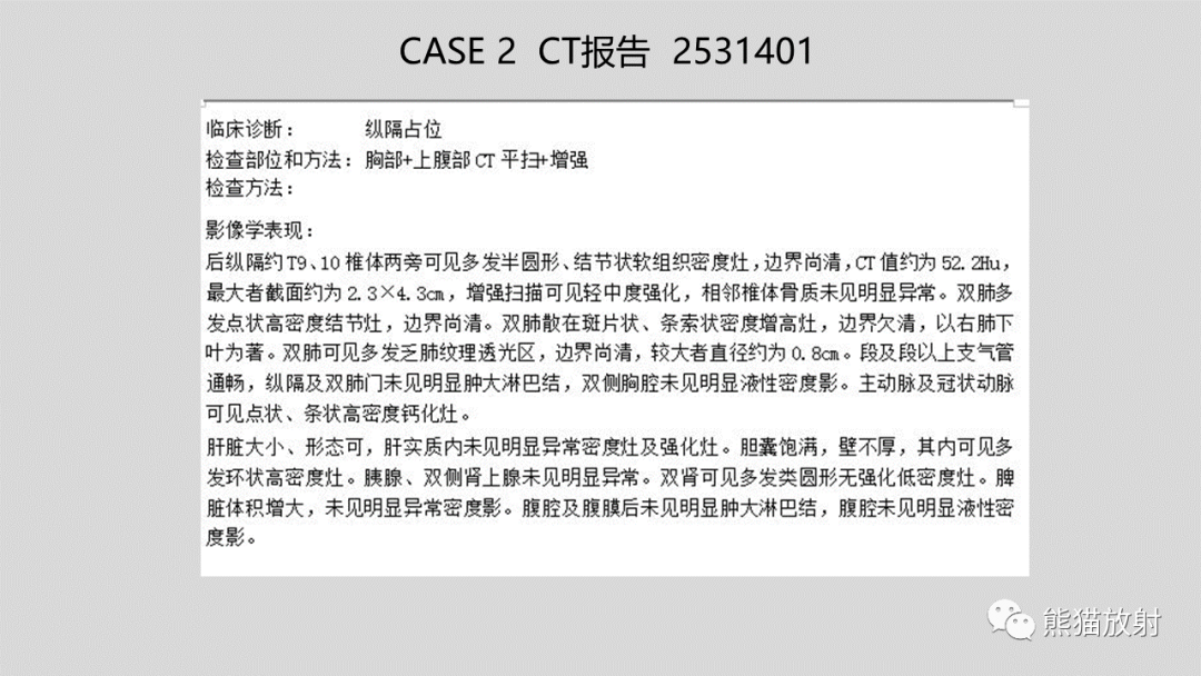 影像PPT - 【病例】髓外造血2例CT影像-19