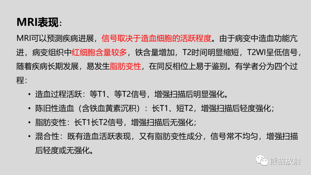 影像PPT - 【病例】髓外造血2例CT影像-31