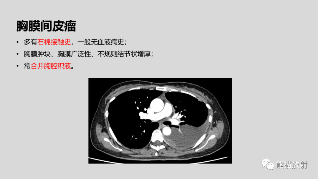 影像PPT - 【病例】髓外造血2例CT影像-36