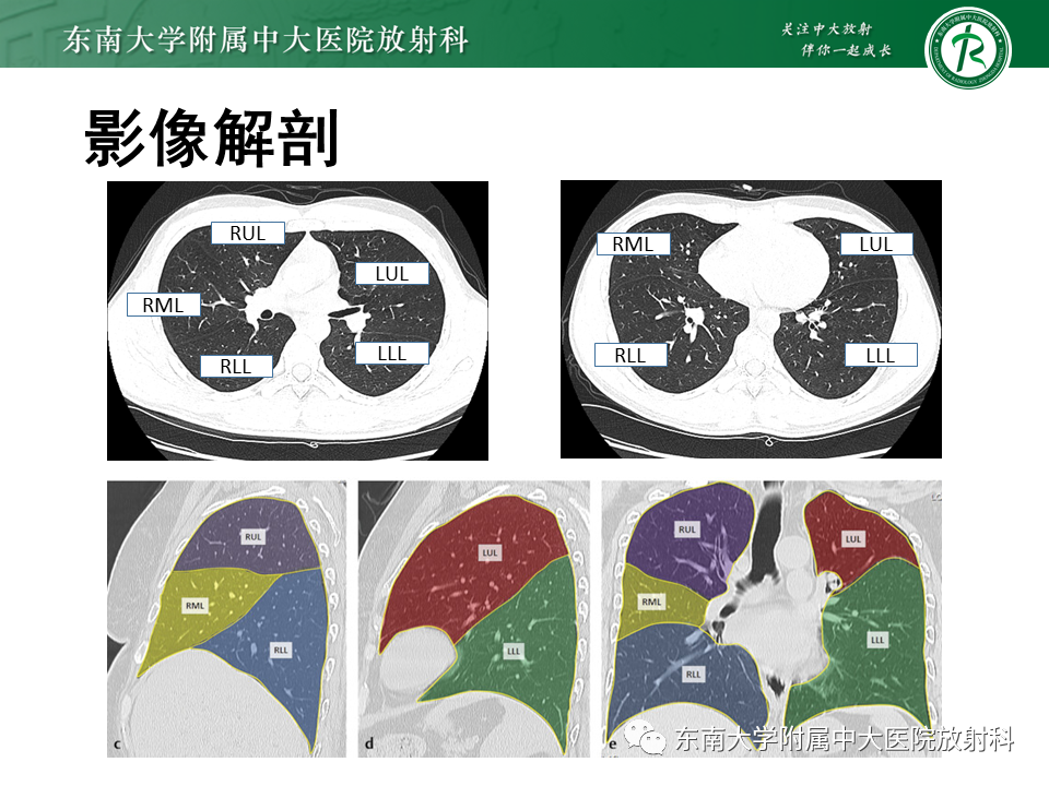 影像PPT - 【PPT】理影外合—肺腺癌疾病谱-9 影像PPT - 【PPT】理影外合—肺腺癌疾病谱-9