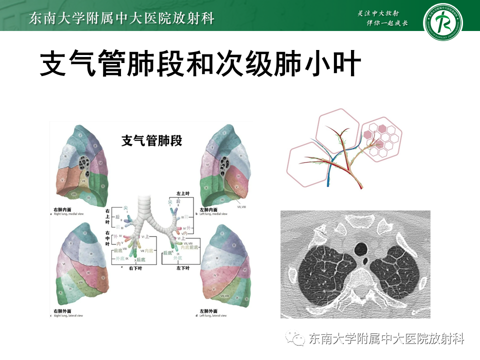 影像PPT - 【PPT】理影外合—肺腺癌疾病谱-10 影像PPT - 【PPT】理影外合—肺腺癌疾病谱-10