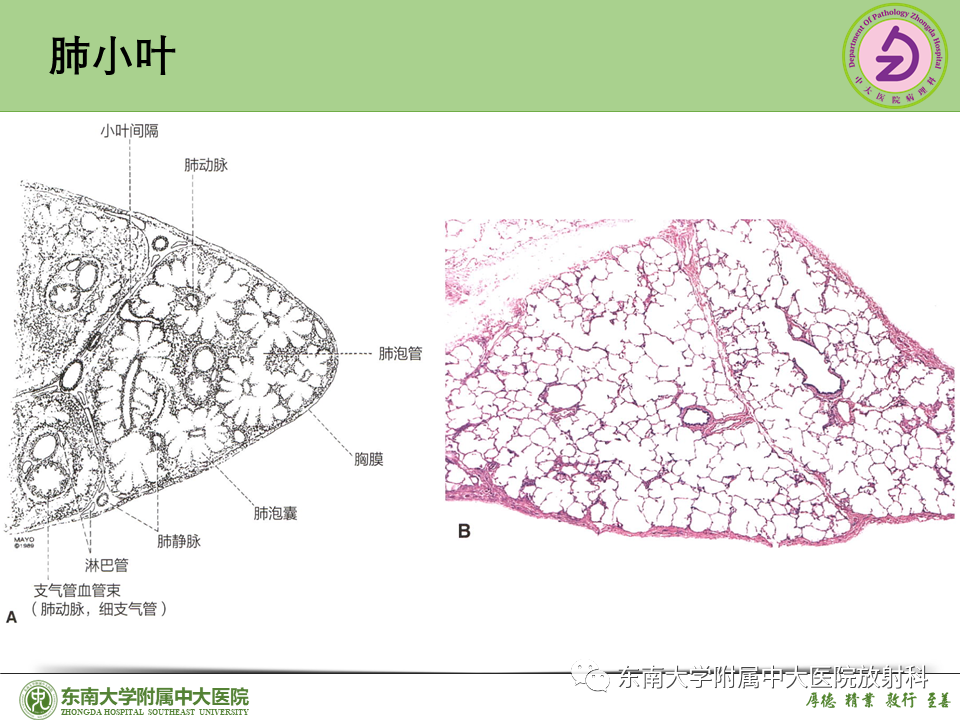 影像PPT - 【PPT】理影外合—肺腺癌疾病谱-11 影像PPT - 【PPT】理影外合—肺腺癌疾病谱-11