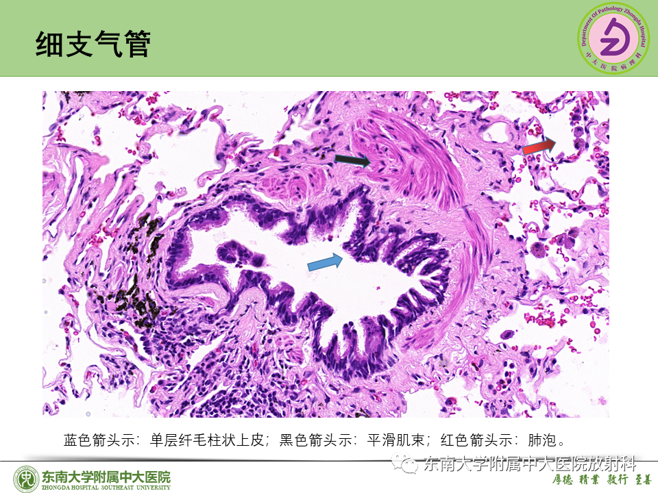 影像PPT - 【PPT】理影外合—肺腺癌疾病谱-12 影像PPT - 【PPT】理影外合—肺腺癌疾病谱-12