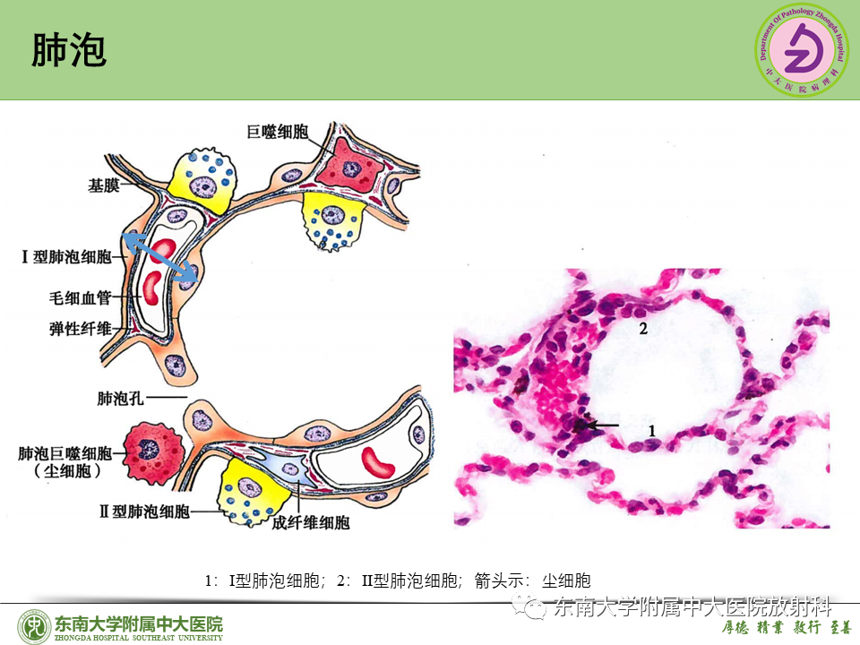 影像PPT - 【PPT】理影外合—肺腺癌疾病谱-14 影像PPT - 【PPT】理影外合—肺腺癌疾病谱-14