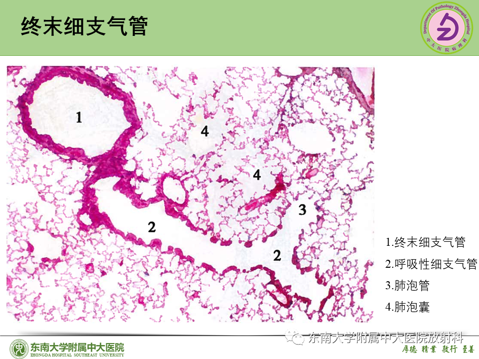 影像PPT - 【PPT】理影外合—肺腺癌疾病谱-13 影像PPT - 【PPT】理影外合—肺腺癌疾病谱-13