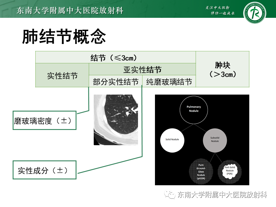 影像PPT - 【PPT】理影外合—肺腺癌疾病谱-16 影像PPT - 【PPT】理影外合—肺腺癌疾病谱-16