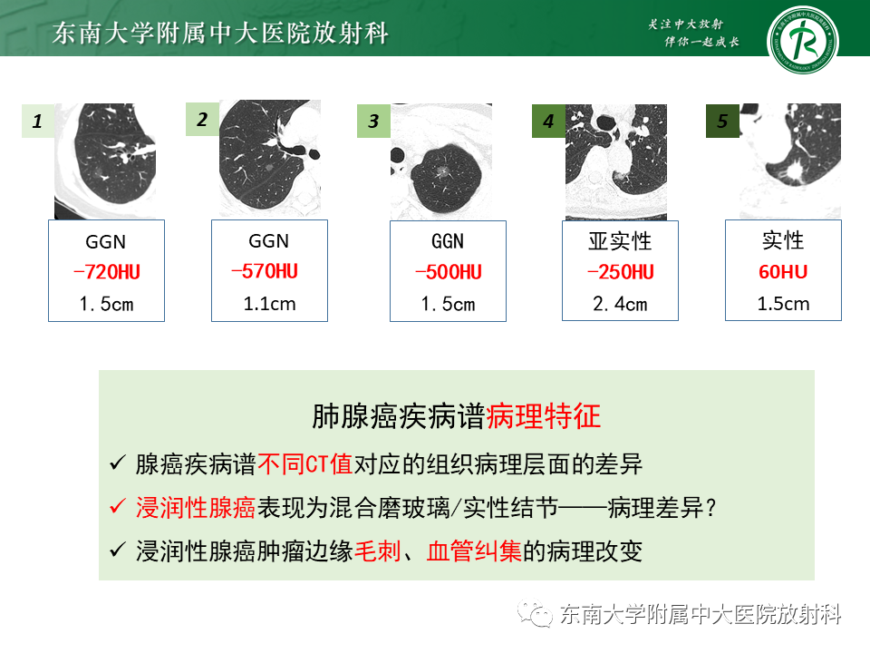 影像PPT - 【PPT】理影外合—肺腺癌疾病谱-23 影像PPT - 【PPT】理影外合—肺腺癌疾病谱-23