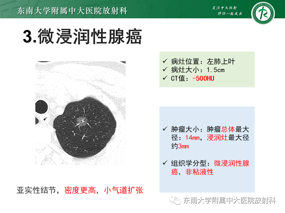 影像PPT - 【PPT】理影外合—肺腺癌疾病谱-19 影像PPT - 【PPT】理影外合—肺腺癌疾病谱-19