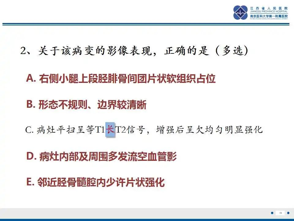影像PPT - 【PPT】腺泡状软组织肉瘤-16