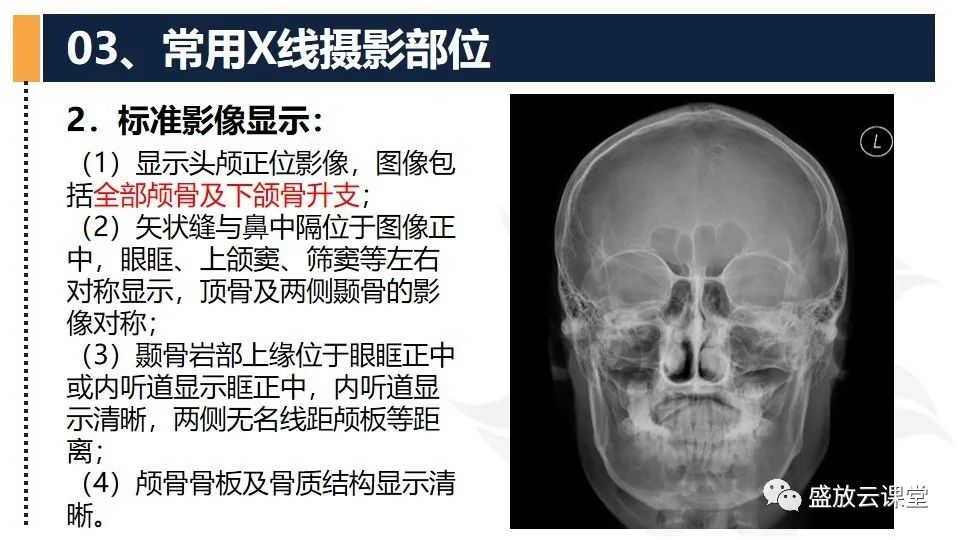 影像PPT - 【PPT】技术共识解读—数字X线摄影检查（一）-13