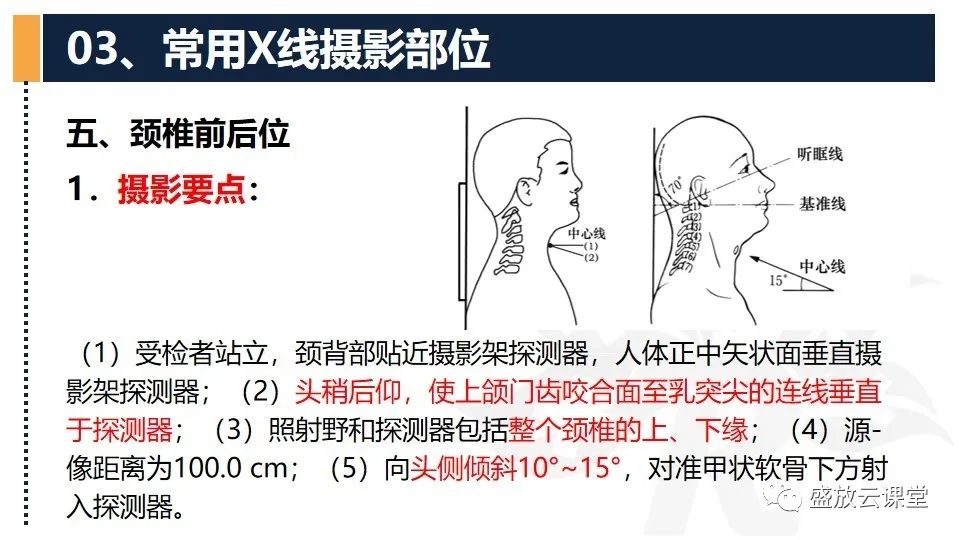影像PPT - 【PPT】技术共识解读—数字X线摄影检查（一）-20