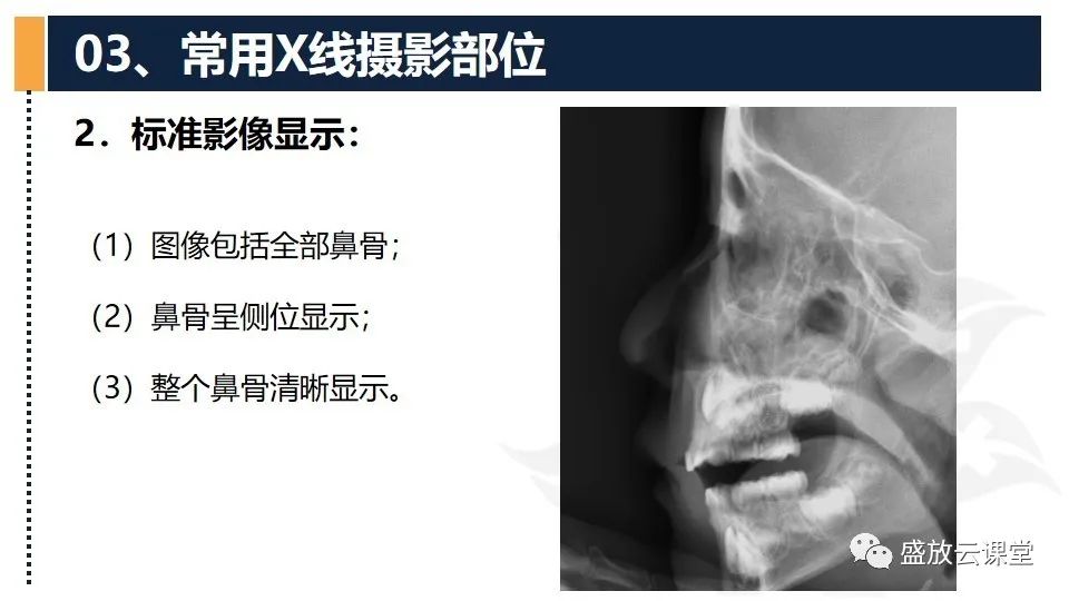 影像PPT - 【PPT】技术共识解读—数字X线摄影检查（一）-17