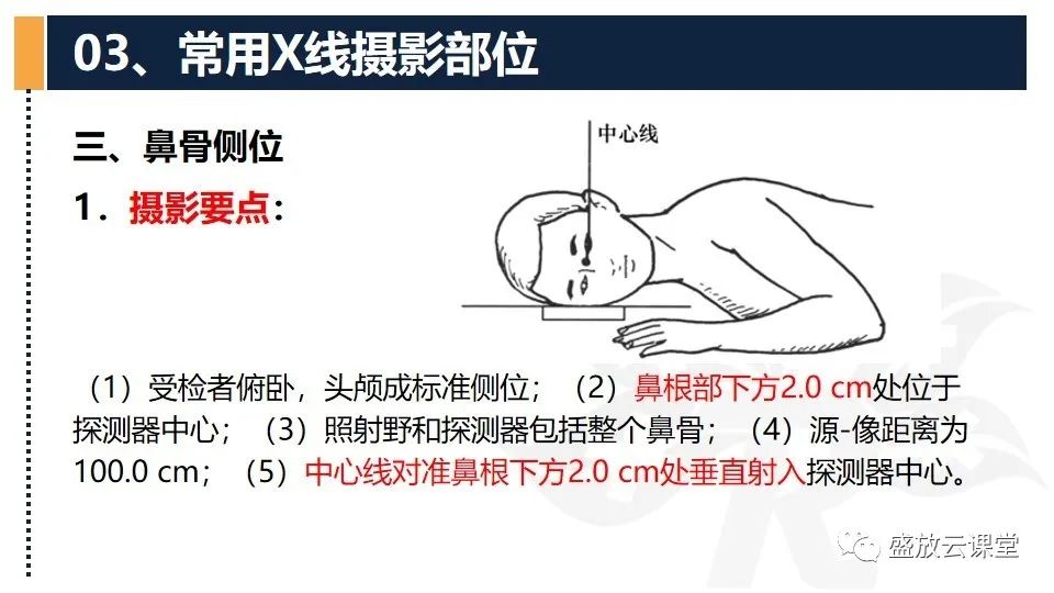 影像PPT - 【PPT】技术共识解读—数字X线摄影检查（一）-16