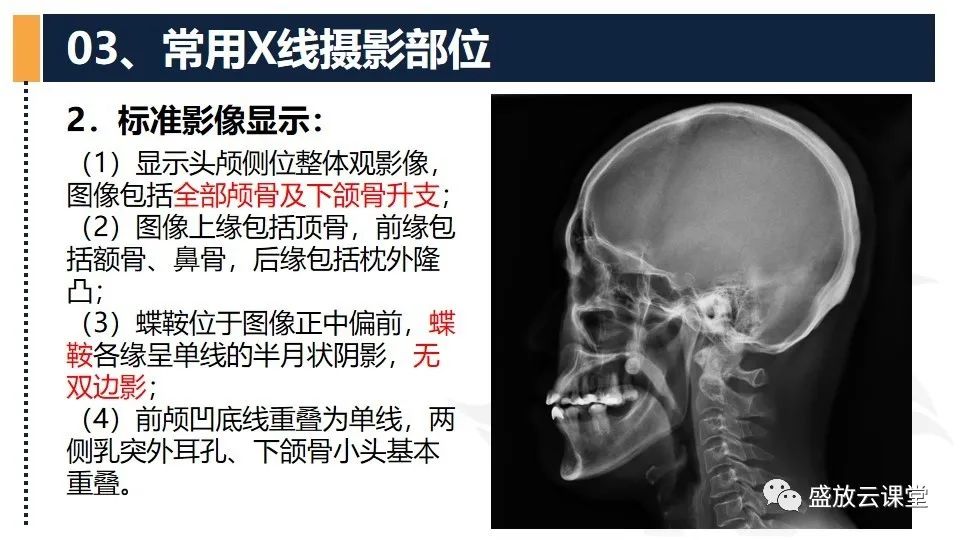 影像PPT - 【PPT】技术共识解读—数字X线摄影检查（一）-15