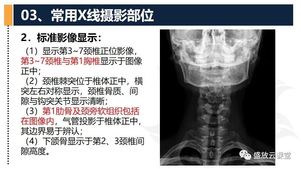 影像PPT - 【PPT】技术共识解读—数字X线摄影检查（一）-21