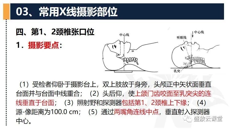 影像PPT - 【PPT】技术共识解读—数字X线摄影检查（一）-18