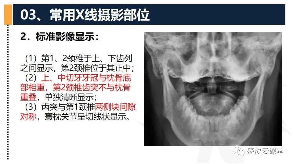 影像PPT - 【PPT】技术共识解读—数字X线摄影检查（一）-19