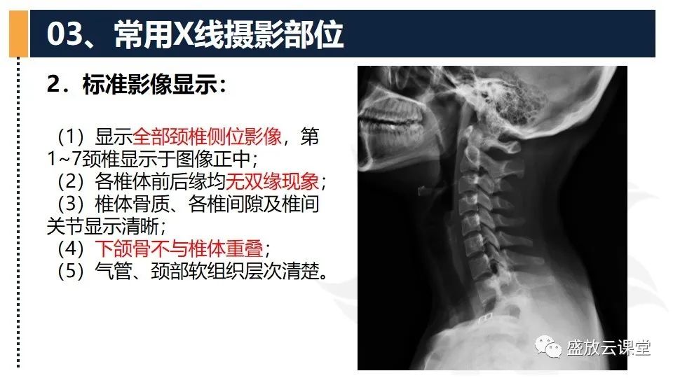 影像PPT - 【PPT】技术共识解读—数字X线摄影检查（一）-23