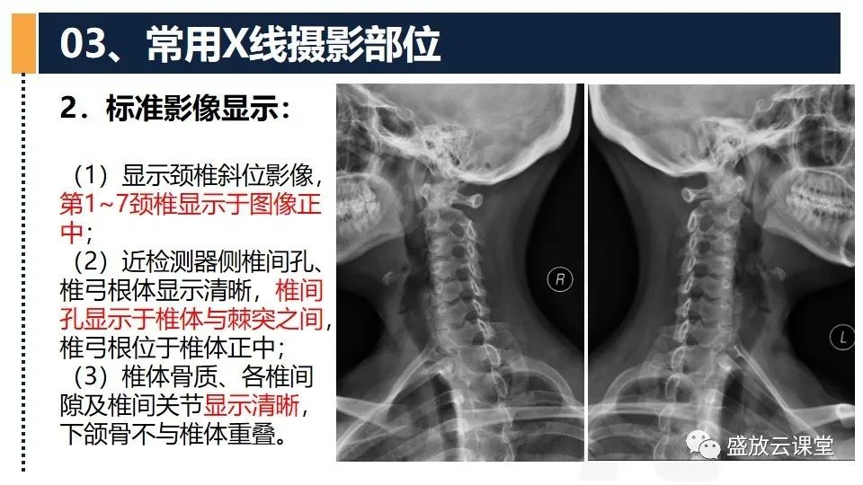 影像PPT - 【PPT】技术共识解读—数字X线摄影检查（一）-25