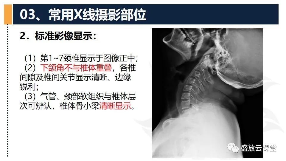 影像PPT - 【PPT】技术共识解读—数字X线摄影检查（一）-27