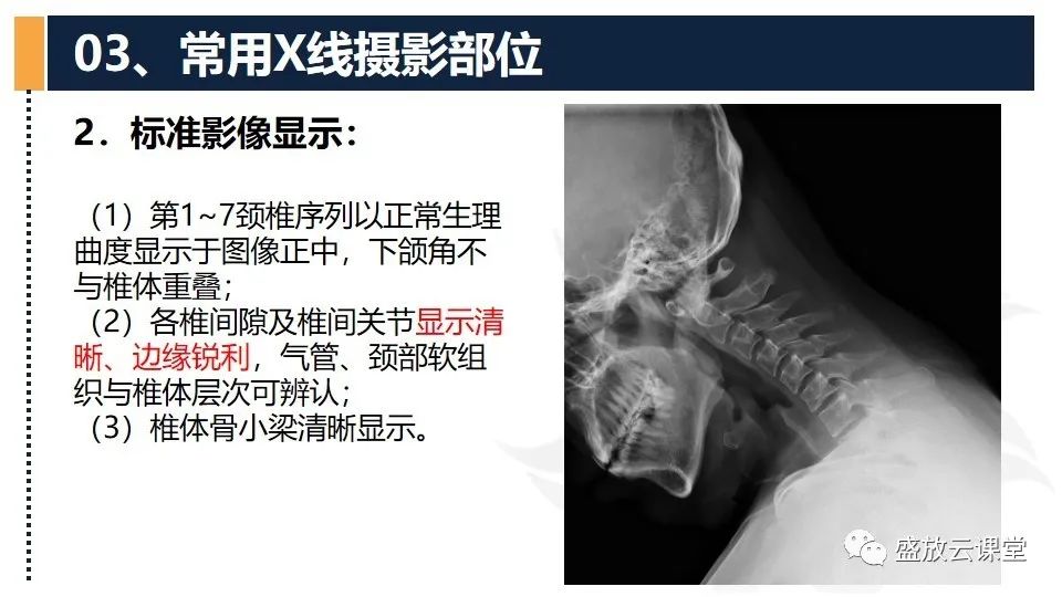 影像PPT - 【PPT】技术共识解读—数字X线摄影检查（一）-29