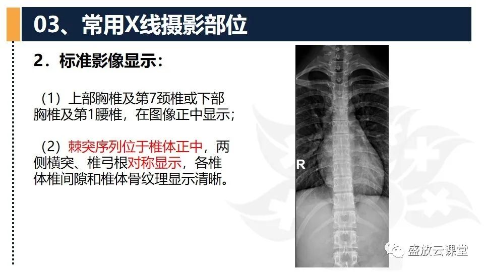 影像PPT - 【PPT】技术共识解读—数字X线摄影检查（一）-31