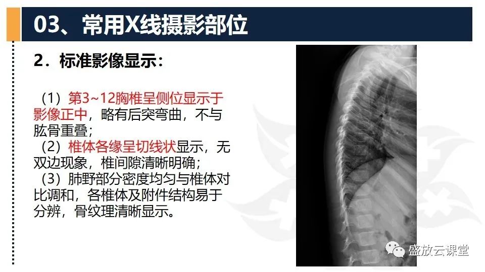 影像PPT - 【PPT】技术共识解读—数字X线摄影检查（一）-33