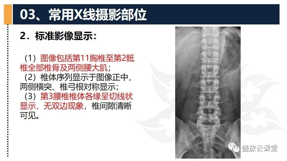 影像PPT - 【PPT】技术共识解读—数字X线摄影检查（一）-35