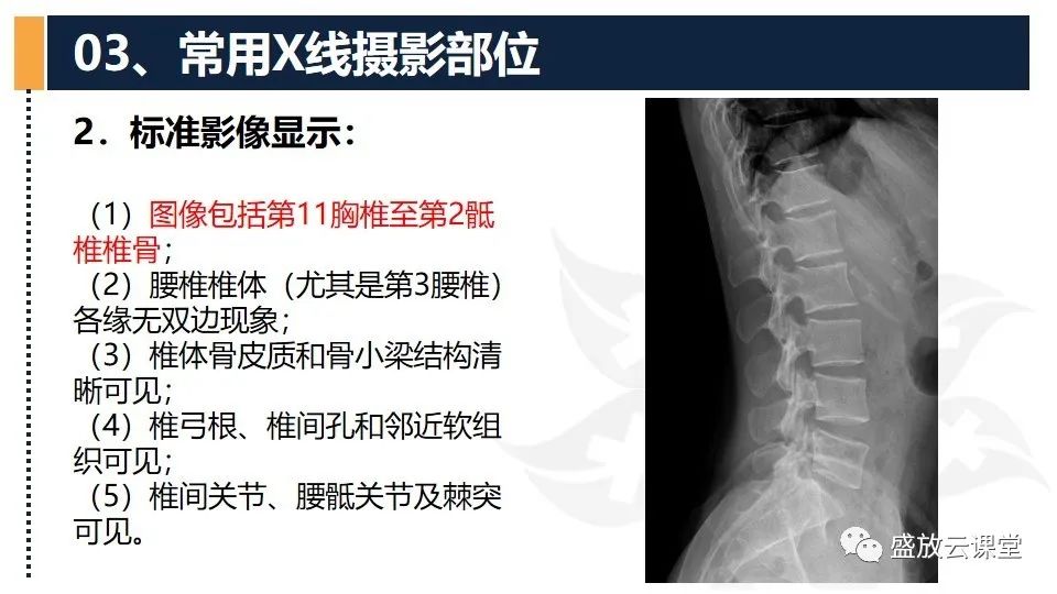 影像PPT - 【PPT】技术共识解读—数字X线摄影检查（一）-37