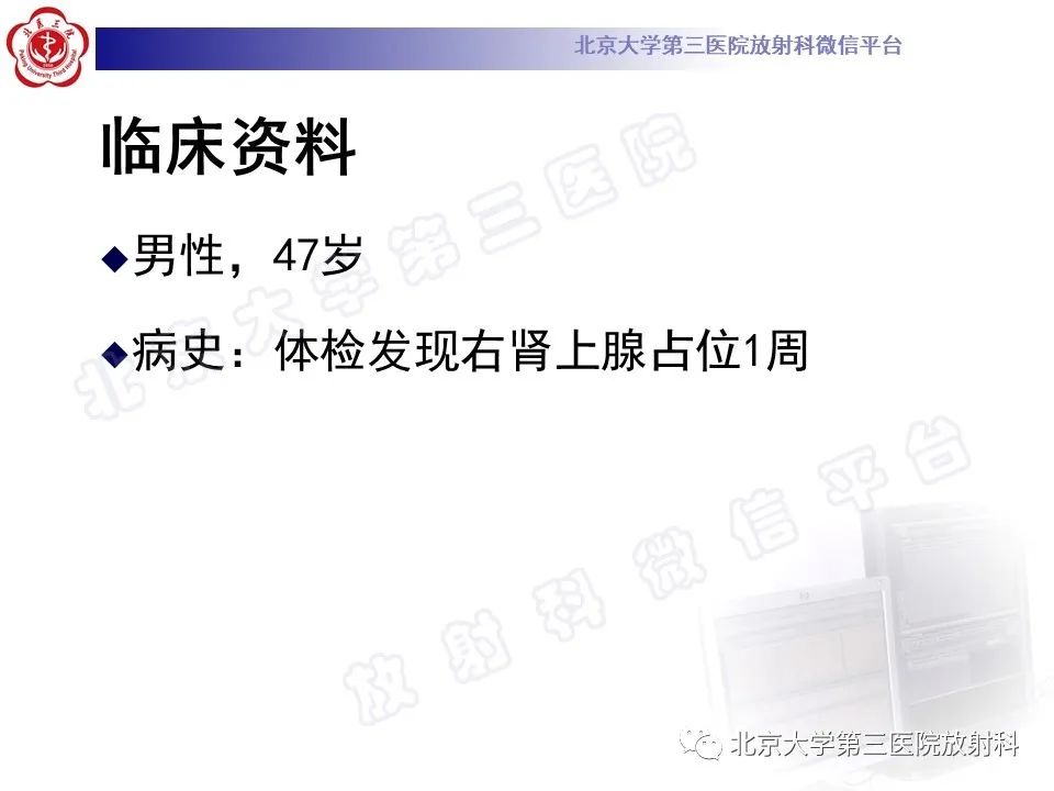 影像PPT - 【PPT】肾上腺血管瘤-2