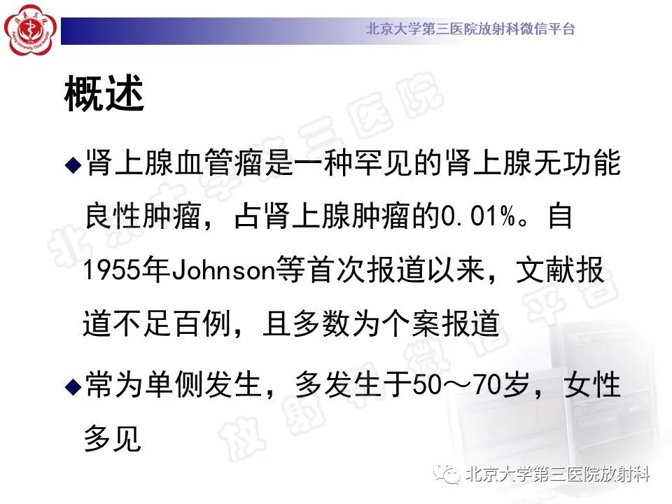 影像PPT - 【PPT】肾上腺血管瘤-8