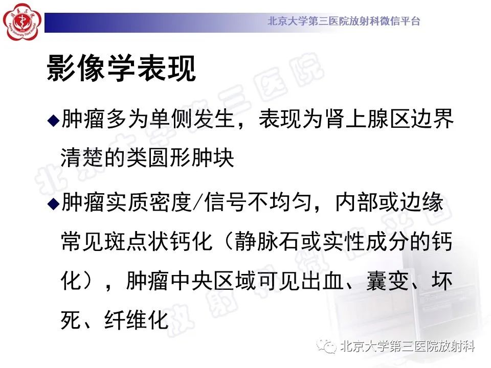 影像PPT - 【PPT】肾上腺血管瘤-14