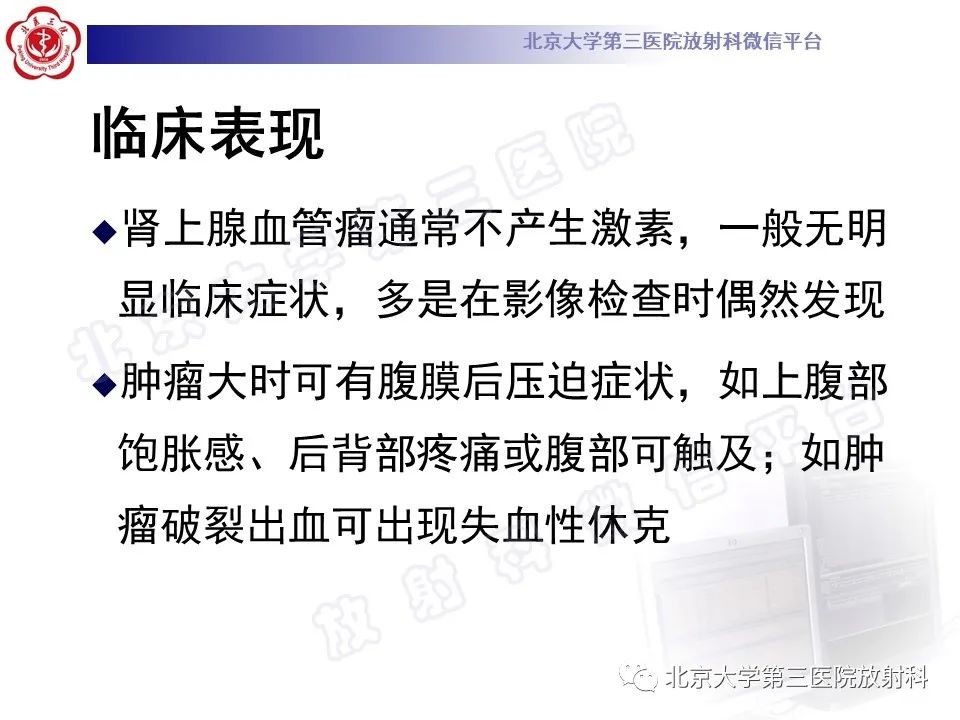 影像PPT - 【PPT】肾上腺血管瘤-13