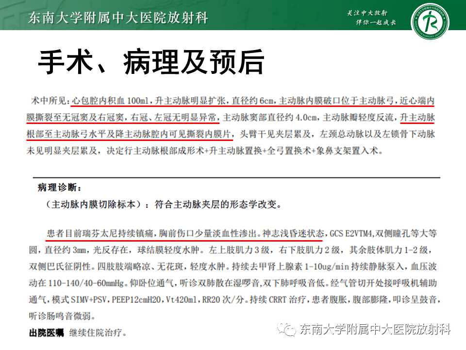 影像PPT - 【PPT】主-肺动脉共同外膜鞘血肿-20