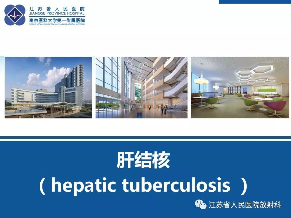 影像PPT - 【PPT】肝结核-32